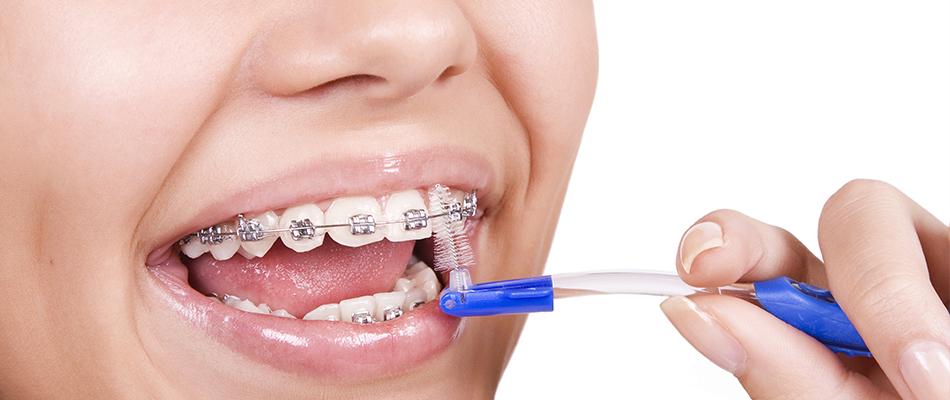 What Does Orthodontics Mean?